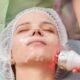 RF Skin Tightening