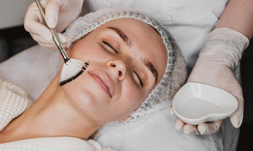 Light Chemical Peels