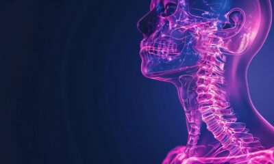 Turtle Neck Syndrome