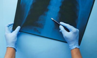Medical Malpractice