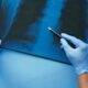 Medical Malpractice