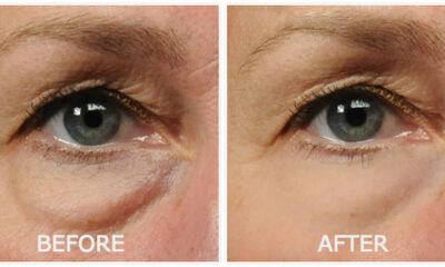 Lucent Skin Products