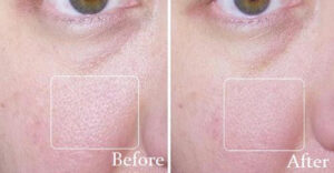 Lucent Skin Products