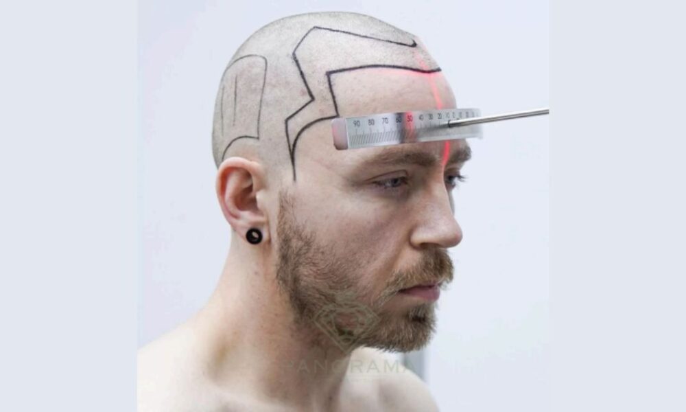 Beginning for Your Hair