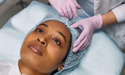 Understanding the Benefits of Botox Beyond Beauty