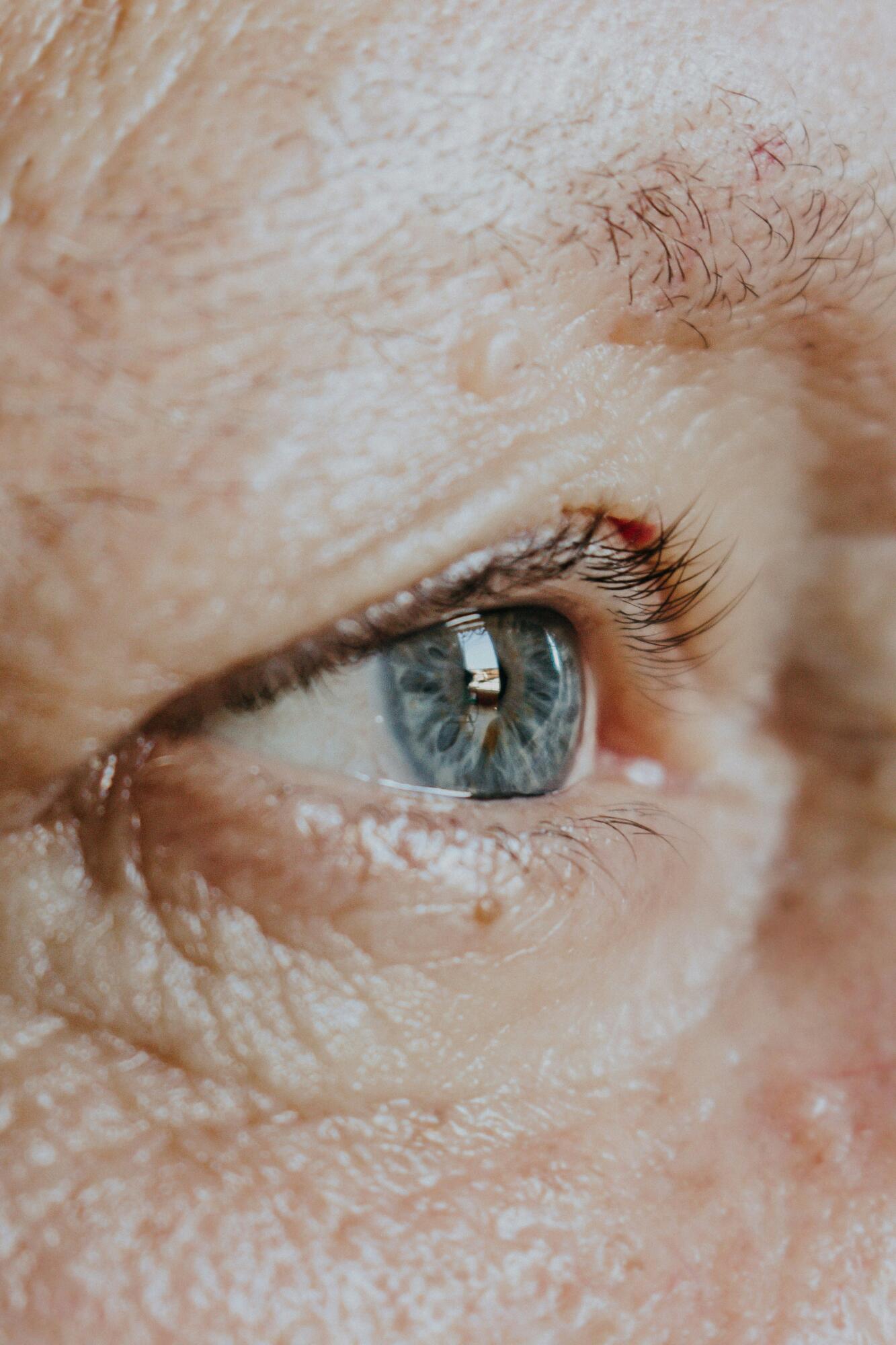 Senior Diabetic Cataracts: Early Signs and Effective Treatments